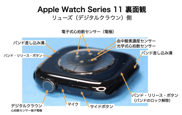 Apple Watch Series 11